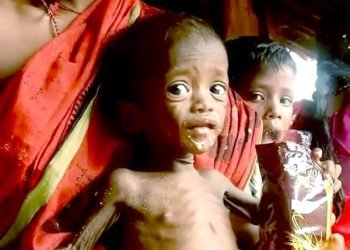 Fight Against Acute Malnutrition Among Children; Special Centres Set Up in Odisha